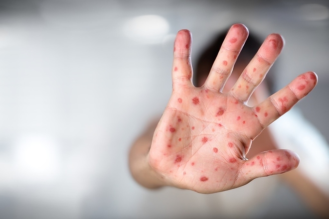 kanyaro_ill.jpeg kanyaro_ill.jpeg