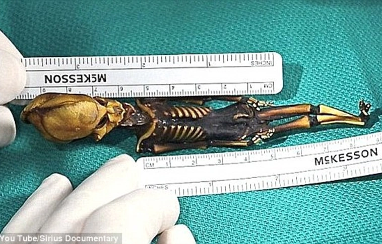 Nem UFÓ, hanem egy 15 hetes magzat volt a chilei csontváz