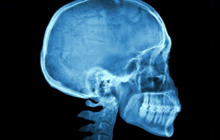 Koponyasérültek diagnosztikájához szükséges új eszköz kifejlesztésében vesznek részt magyar kutatók