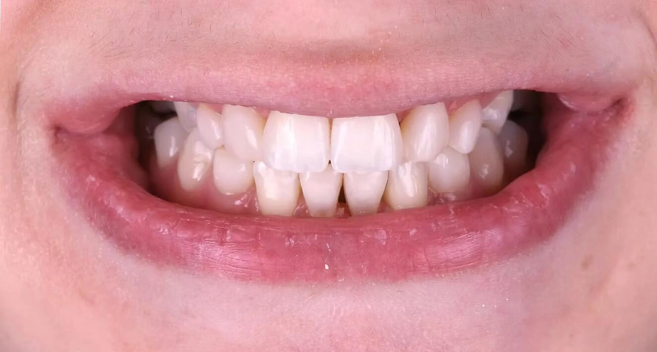 https-_www.potidental.com_ - 2025 május - Cikk5.jpg